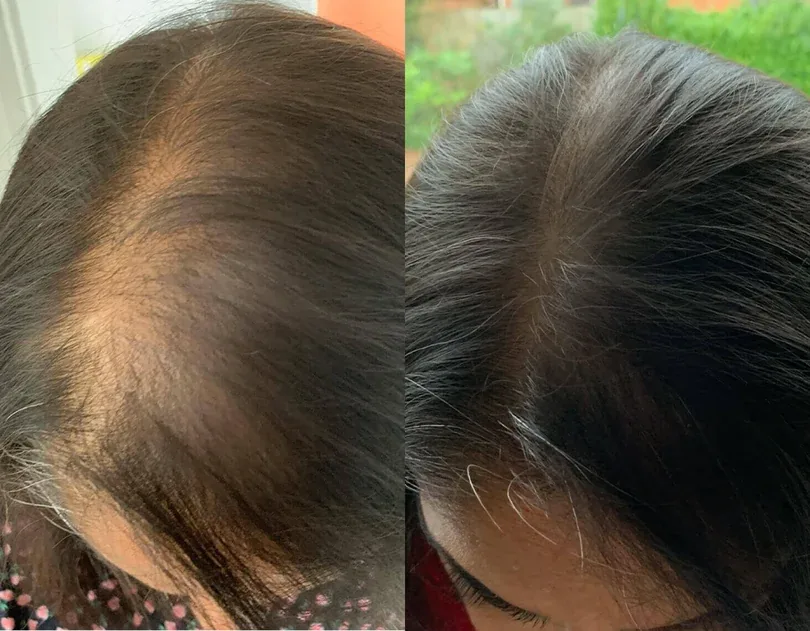Supplied side-by-side photos of the crown and part line